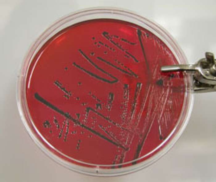 Бактериологическое исследование маститов